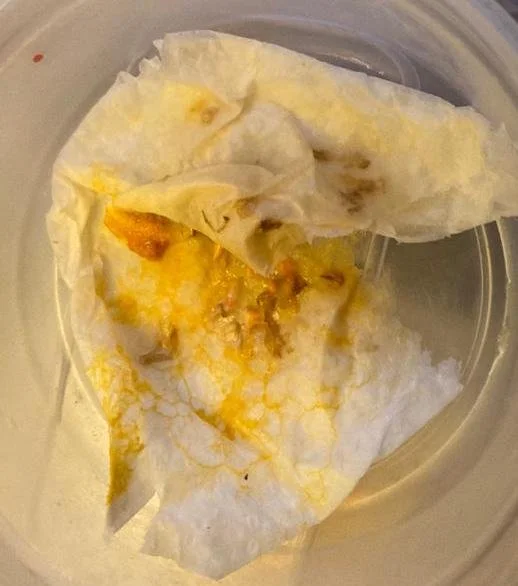 slime mould yukky.jpeg