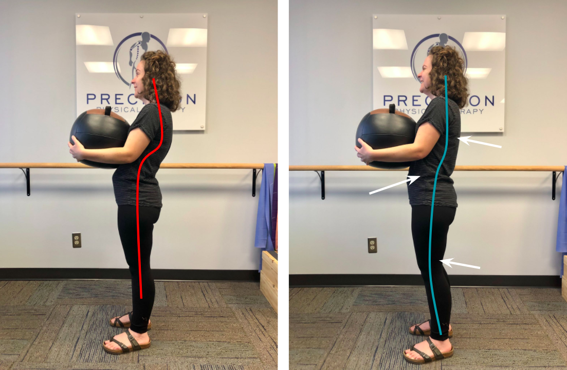 Can you fix slouched posture? — Precision Physical Therapy