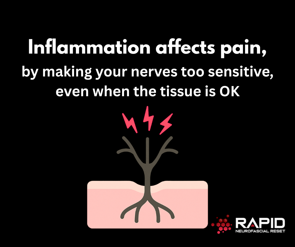 What Really Causes Pain (It’s Not What You Think)