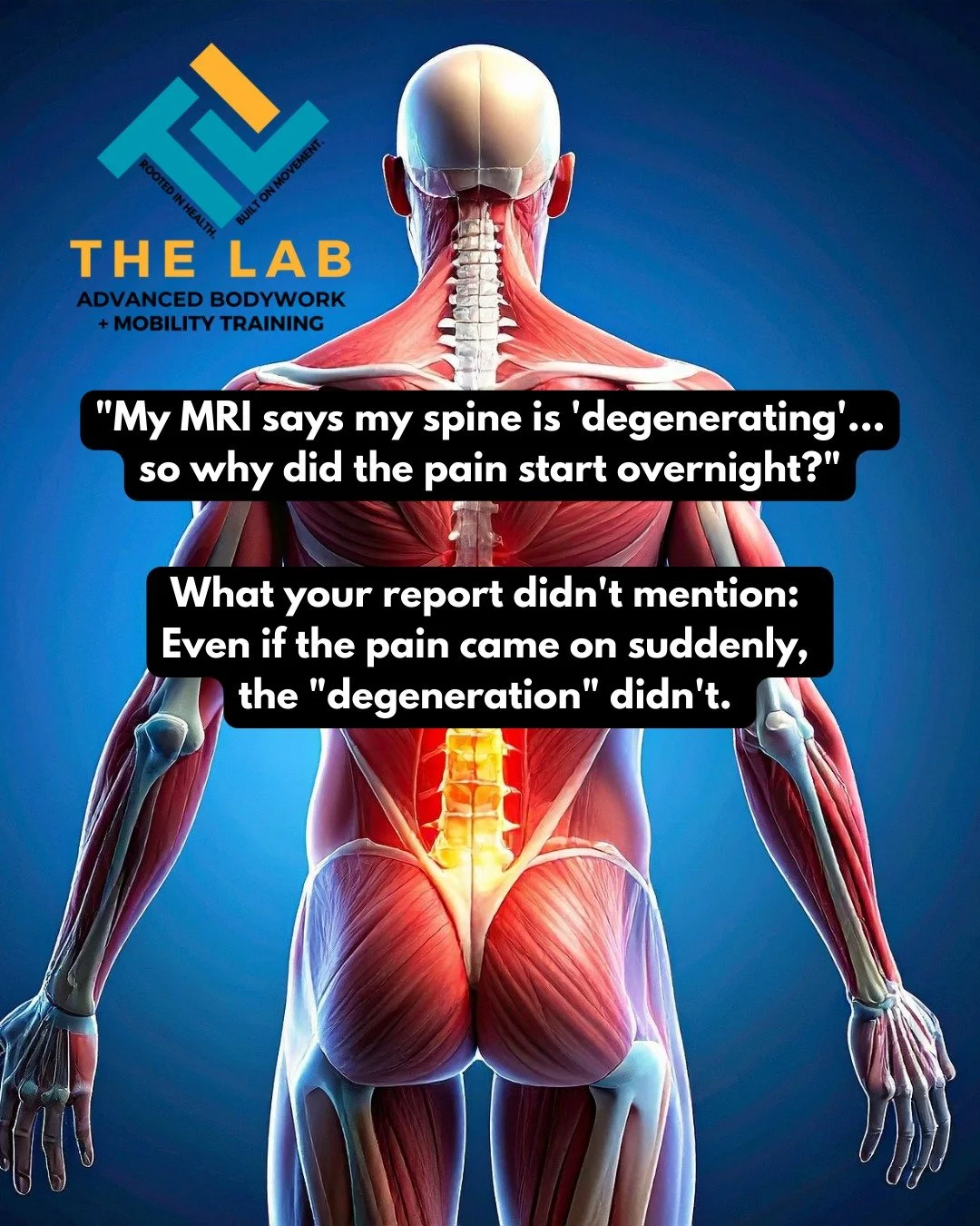If your pain came on suddenly, your &ldquo;degeneration&rdquo; definitely didn&rsquo;t. 🙅&zwj;♂️

Think of DDD like gray hair or wrinkles&mdash;it happens slowly over decades. It doesn&rsquo;t happen overnight! If you were fine on Tuesday and in ago