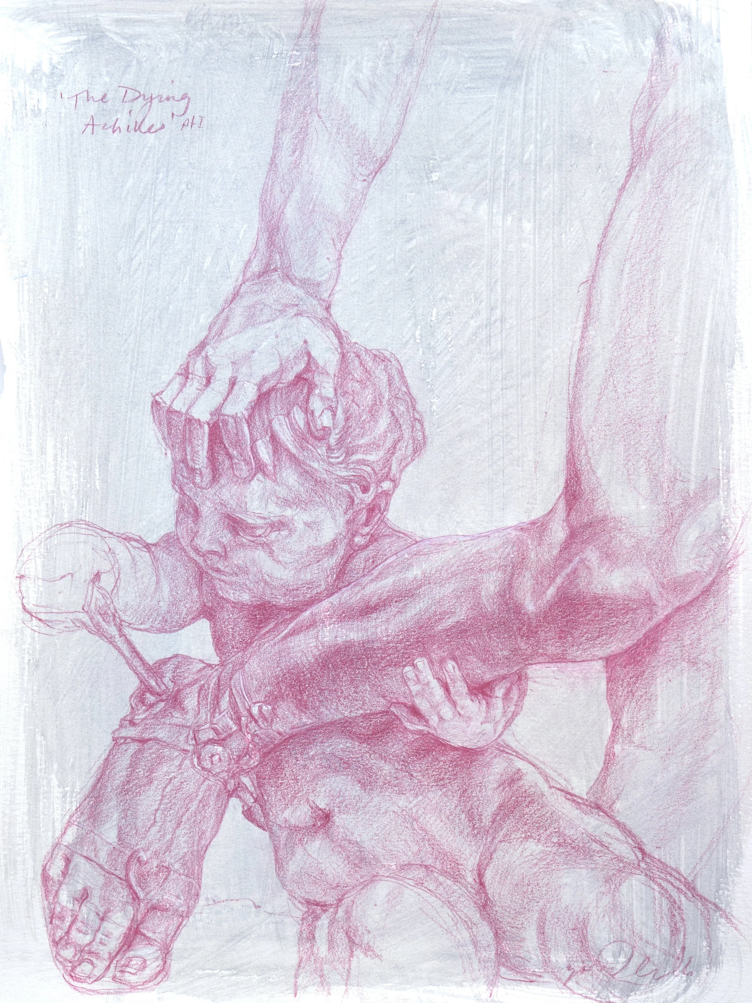 The Dying Achilles pt1.jpg