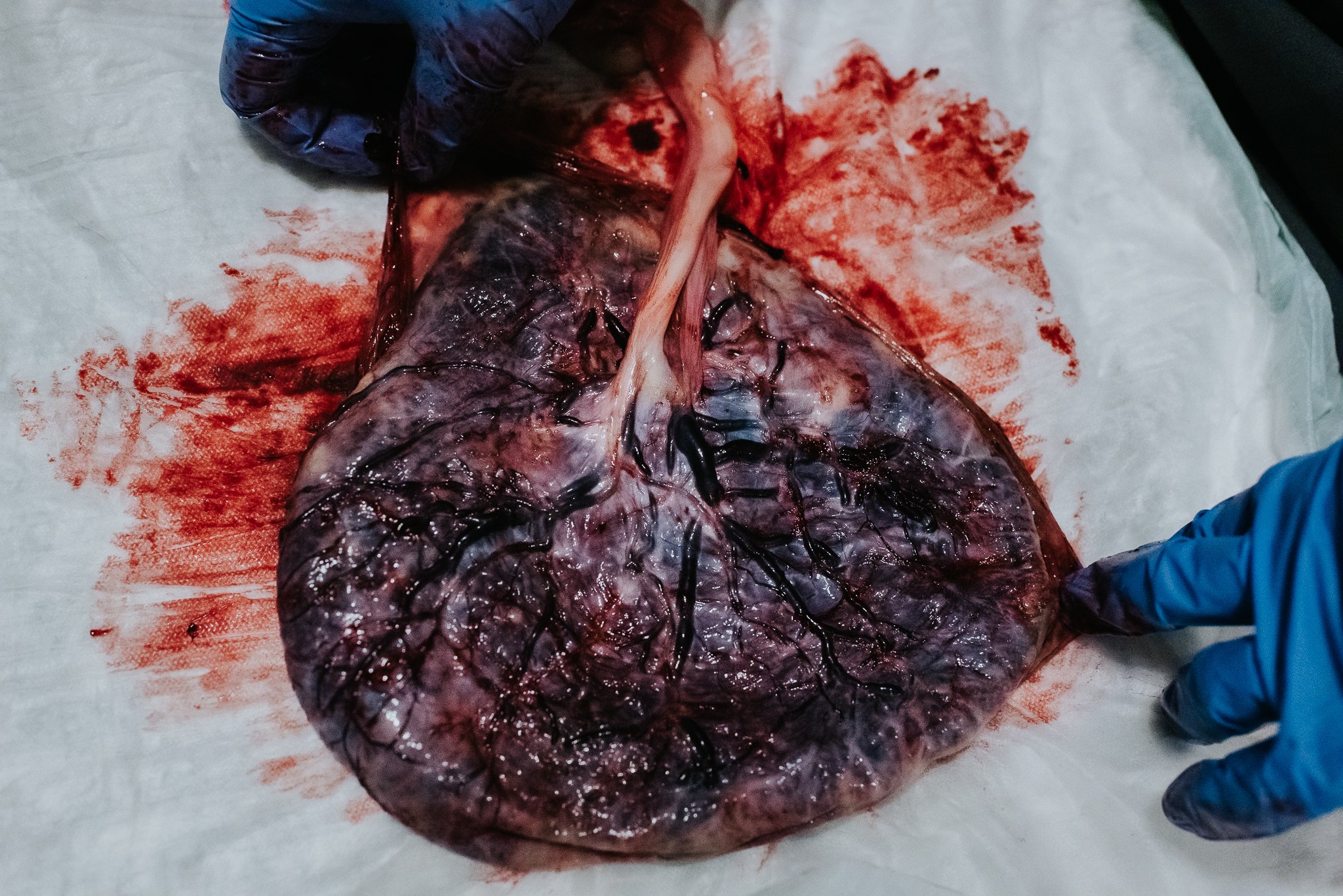 The-amazing-placenta-disposable-organ