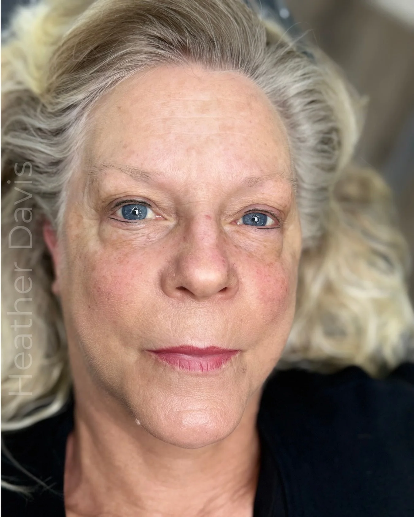 💋 Enhance Your Natural Beauty with Cosmetic Tattooing

At HD Aesthetics, we offer advanced cosmetic tattoo services designed to create lasting, natural-looking results.

✨ Lip Blushing softly enhances your natural lip tone, improves definition, and 
