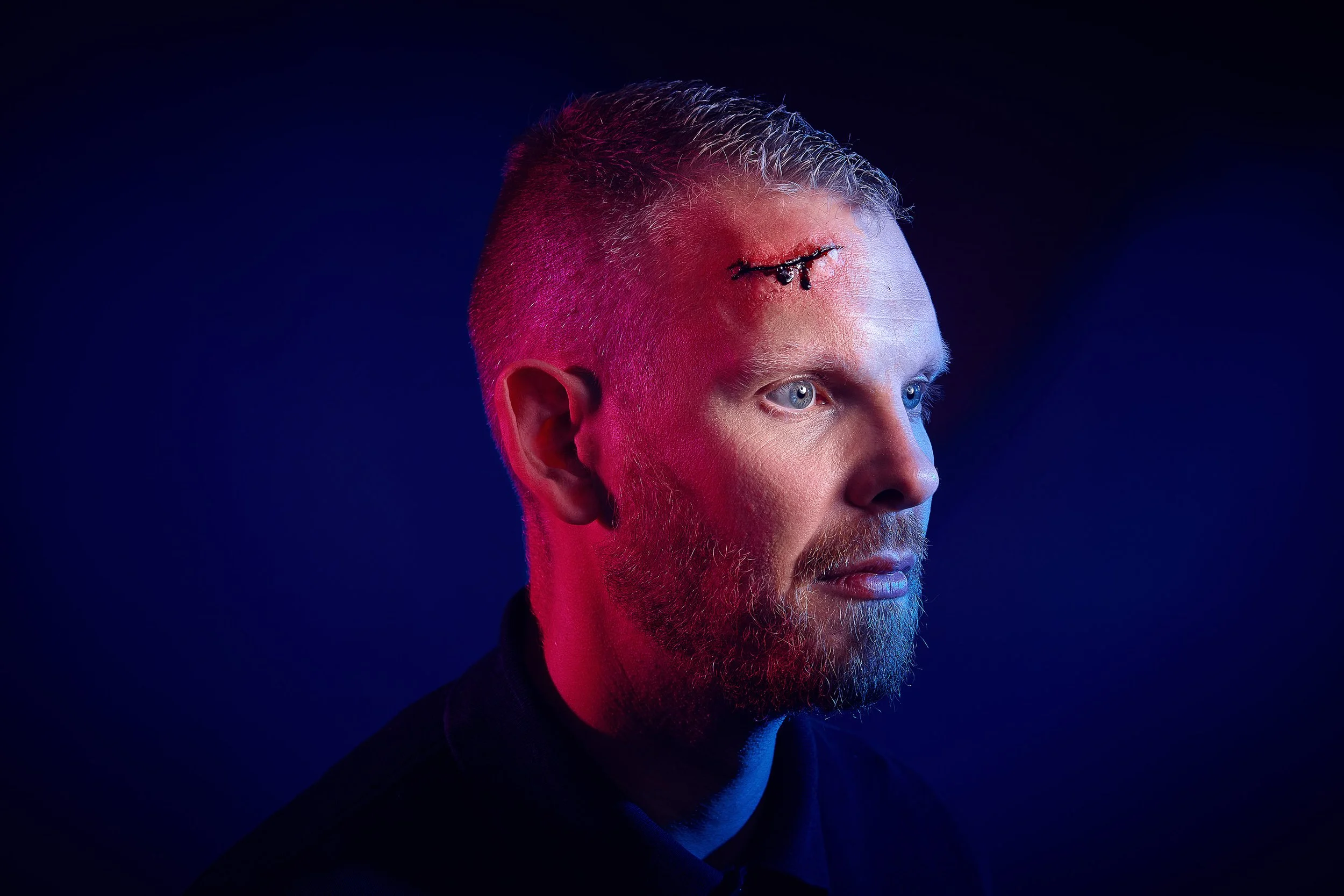 Arbeiter mit Platzwunde, Arbeitsschutz 