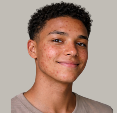 Close-up of a person with closed eyes and hand on forehead, displaying calmness.