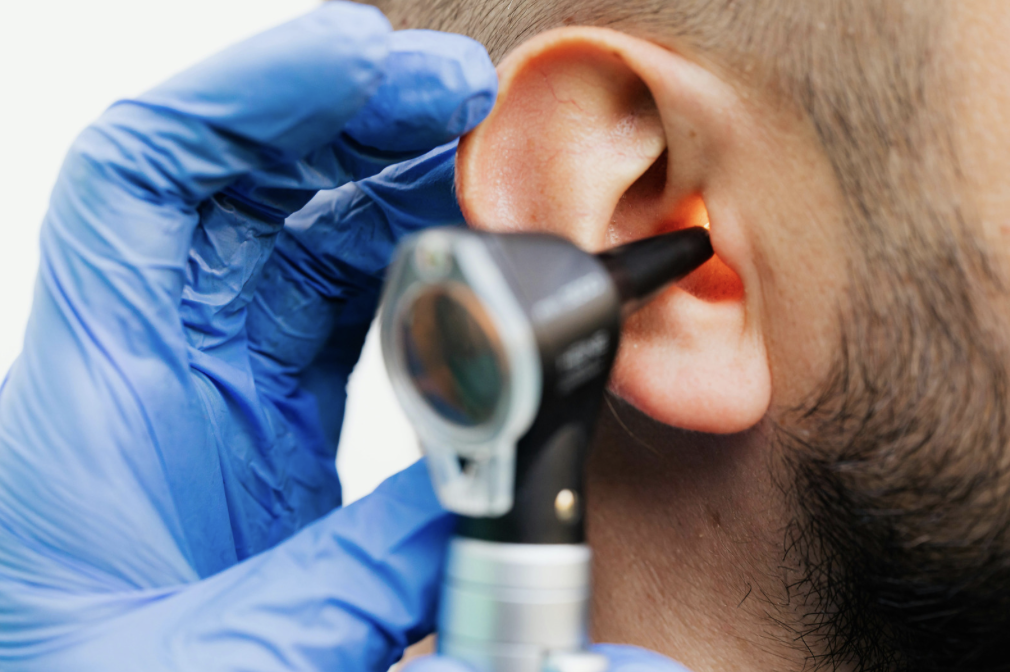 Ear Wax Removal in Frome and Nearby Areas: Why Choose a Professional?