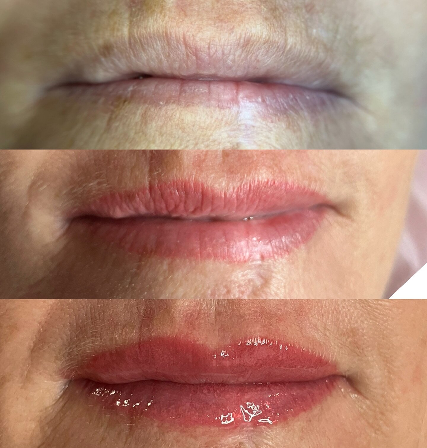 Lip Blush post cancer removal ✨

My client had some skin cancer removed from her lip, I won&rsquo;t go into detail as the story was far too traumatic for her and she has been anxious about the way it looks ever since.

We were able to even out her bo