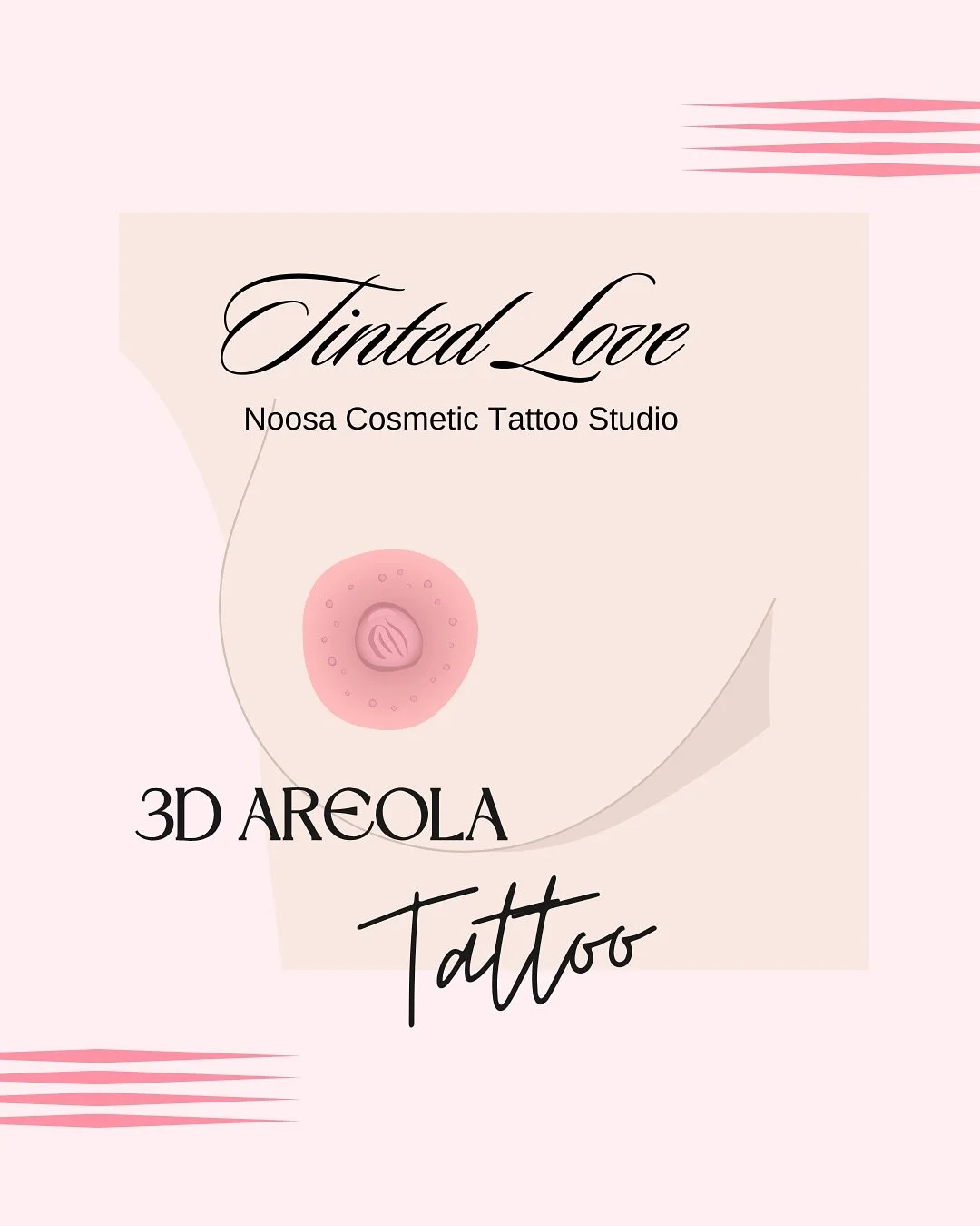 Areola restoration isn&rsquo;t only for women who&rsquo;ve faced breast cancer. It&rsquo;s for anyone who has been through a physical transformation and is ready to reclaim their reflection.

My beautiful client has been on a huge health journey and 