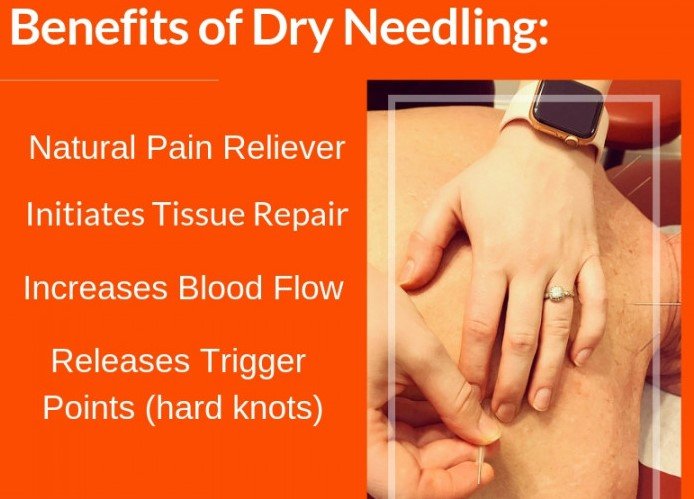needling meh.jpeg