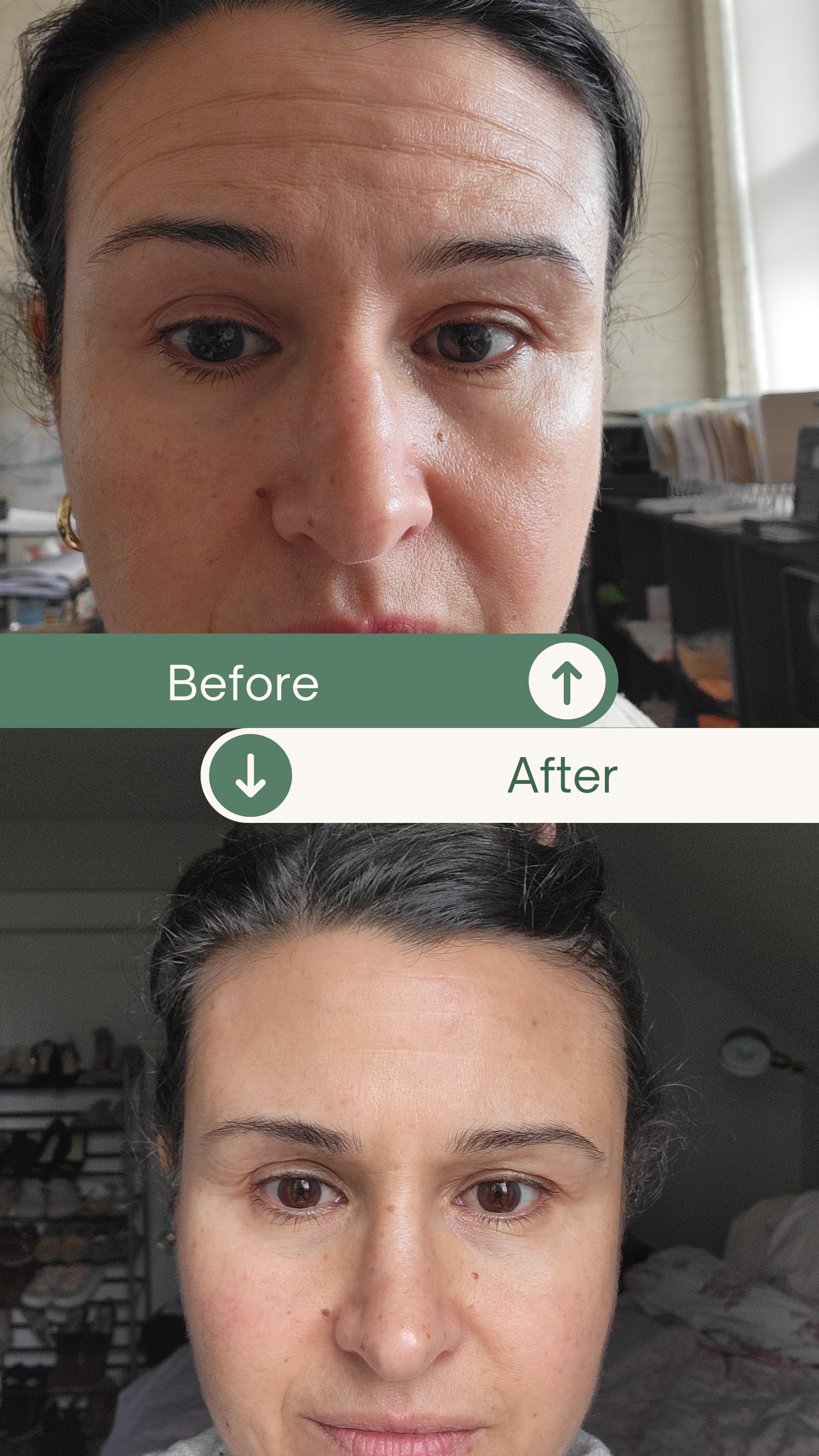 Before & Afters (26).png