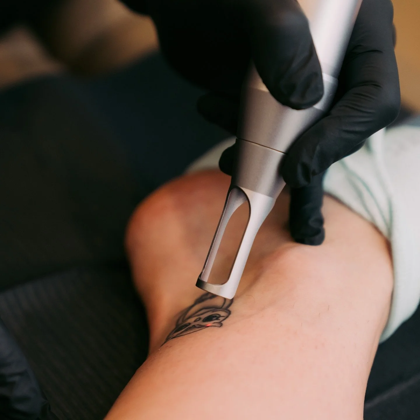 We&rsquo;re saying goodbye to unwanted tattoos in every language:

English: &ldquo;Bu Bye 18th birthday present gone wrong
Spanish: &ldquo;Adi&oacute;s, error de los 2000s.&rdquo;
French: &ldquo;Au revoir, ex&rsquo;s birthday.&rdquo;
Italian: &ldquo;