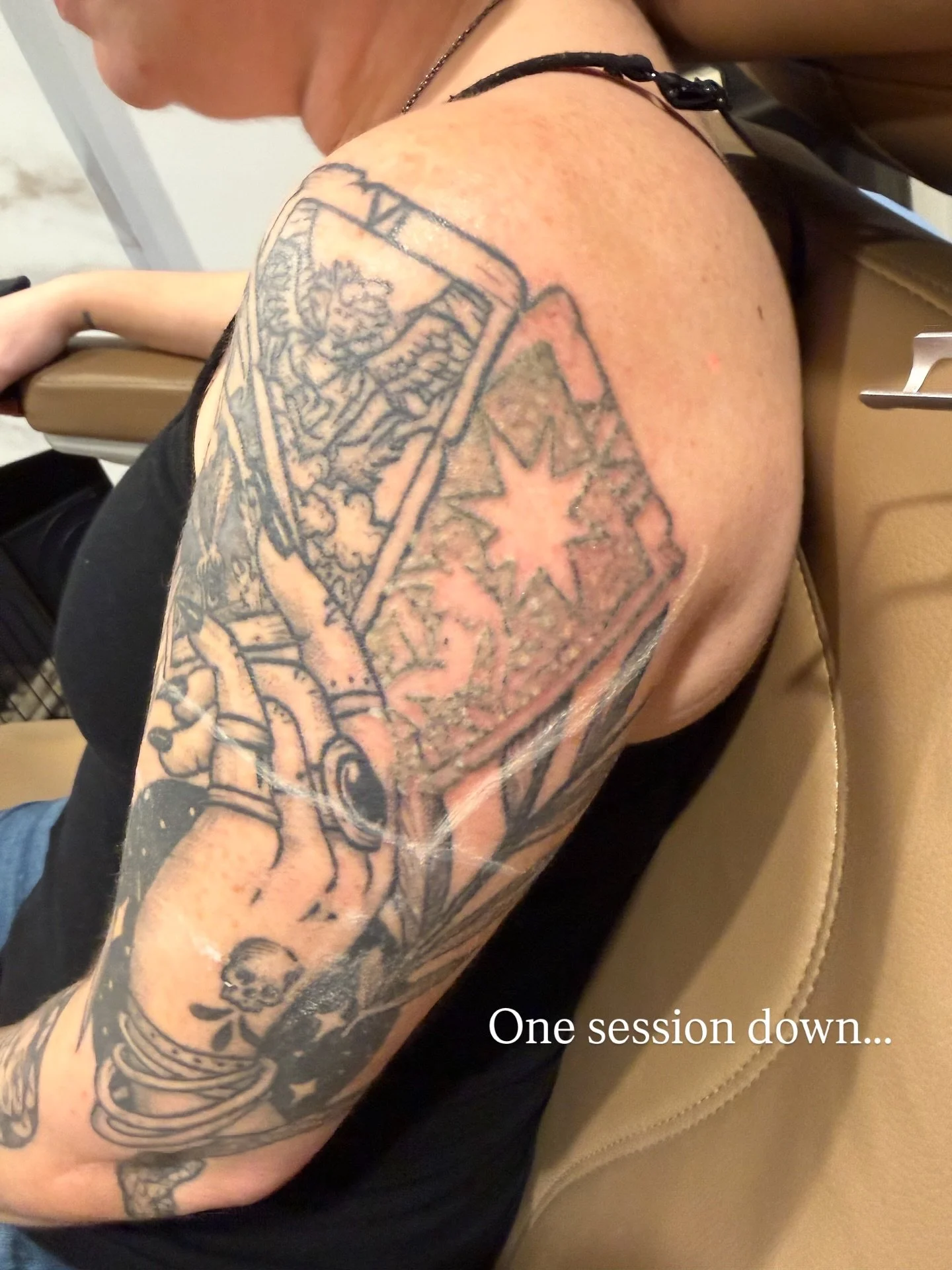 Is your New Year&rsquo;s resolution to start without that one tattoo? @balancedbycharlotte has this one already starting to fade! 

Laser tattoo removal can been a clean slate but it takes a few sessions. We are here to walk you through every step of