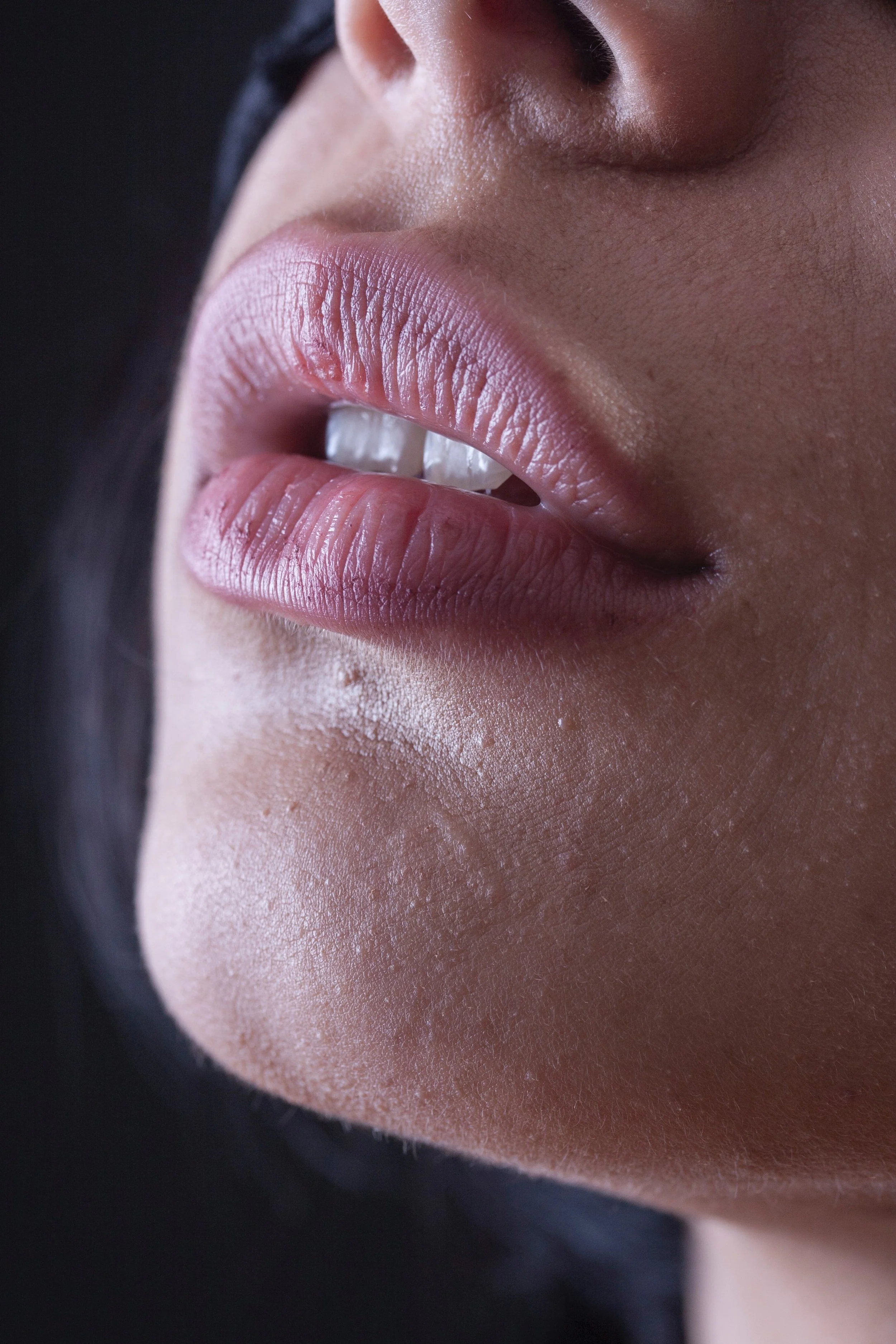 Close-up of a person's lips slightly parted, revealing teeth, with part of the face visible, including the nose and chin, against a dark background.