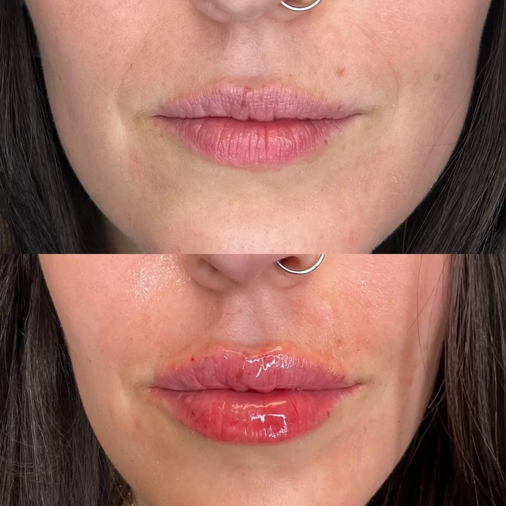 Close-up of a woman's lips before and after applying a clear gloss, with a septum piercing visible.