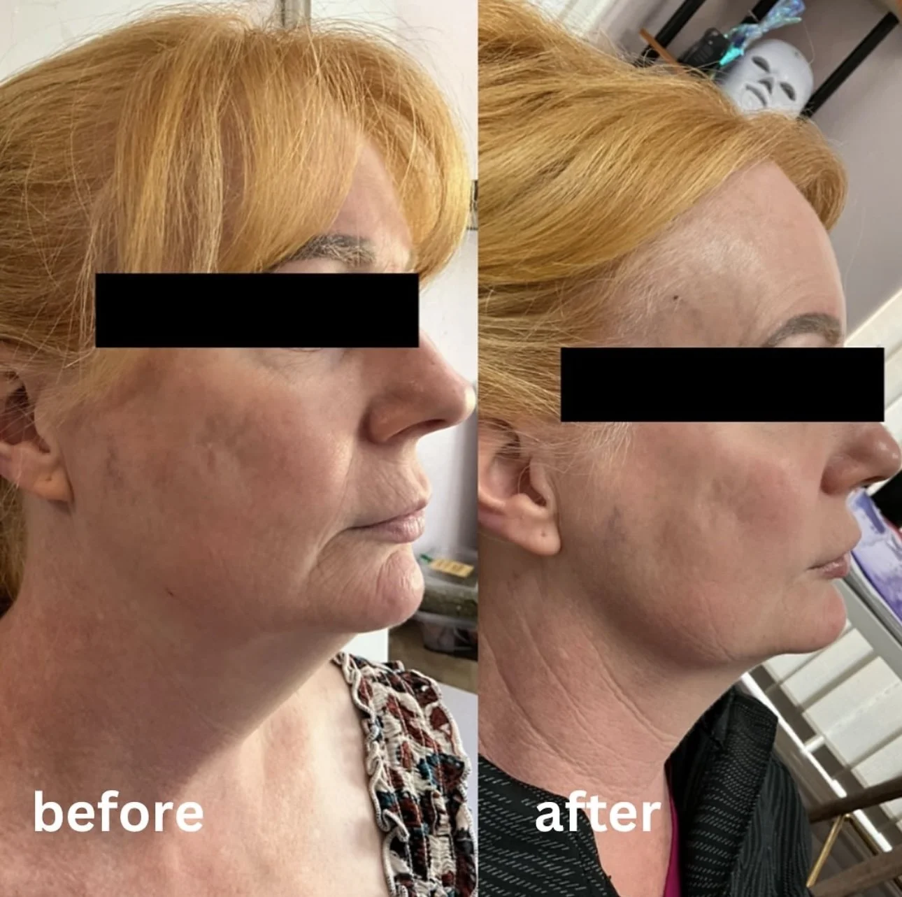 before and afters for website  (8).PNG