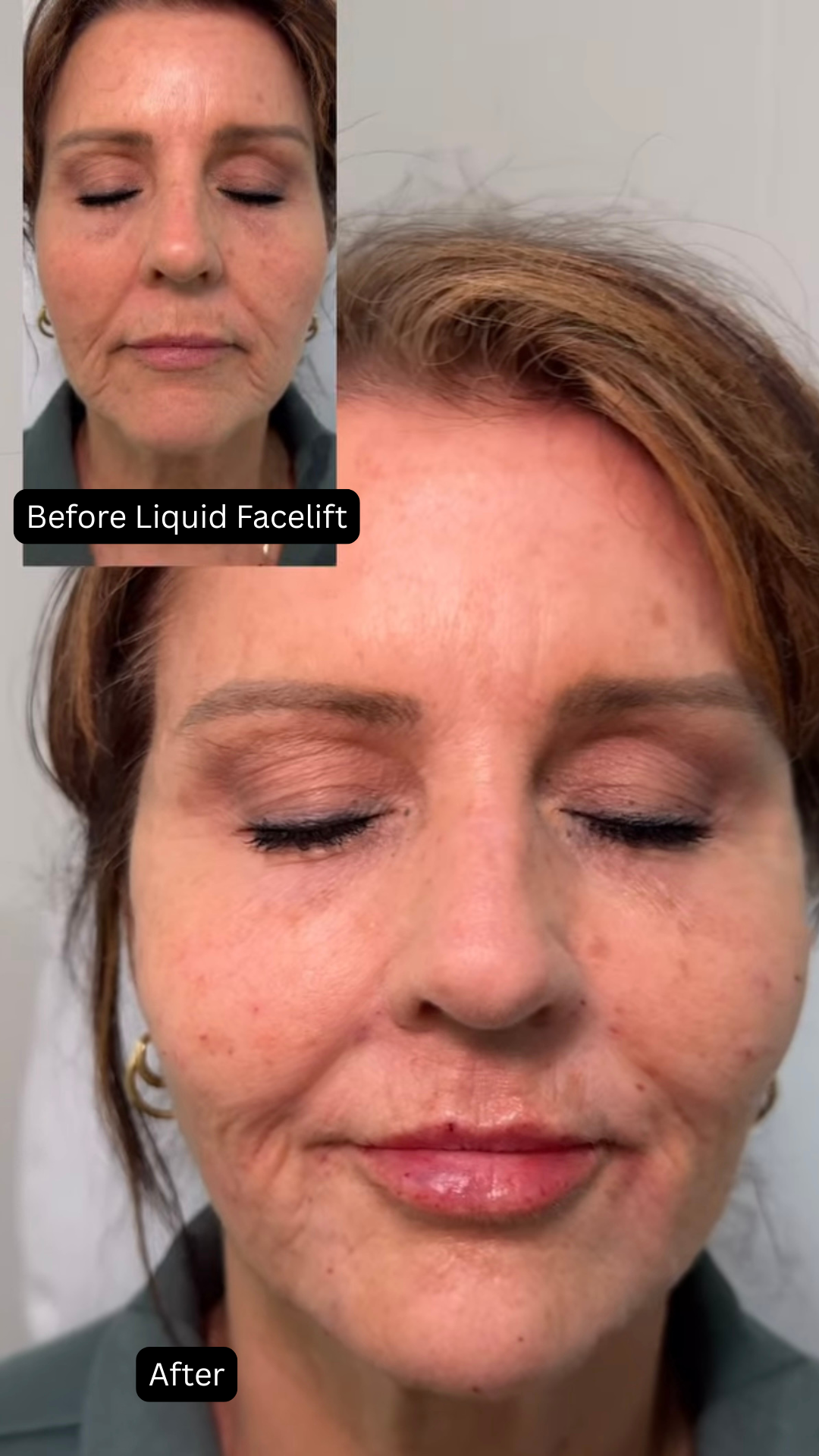 before and afters for website  (7).png