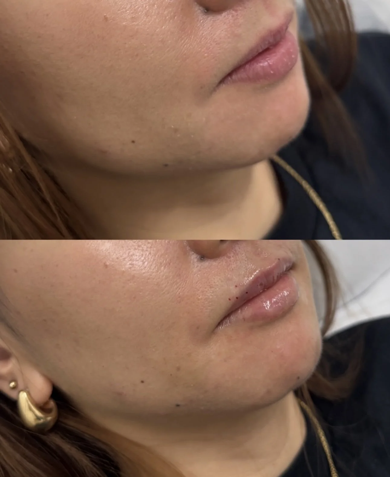 before and afters for website  (5).PNG