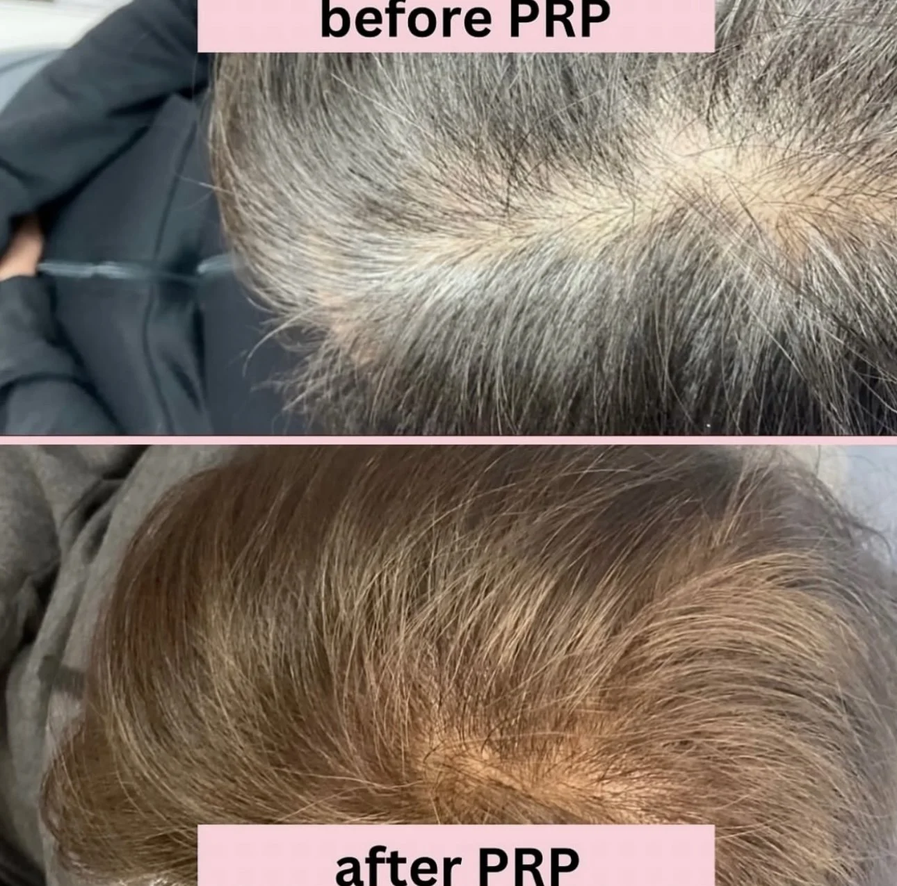 before and afters for website  (4).PNG