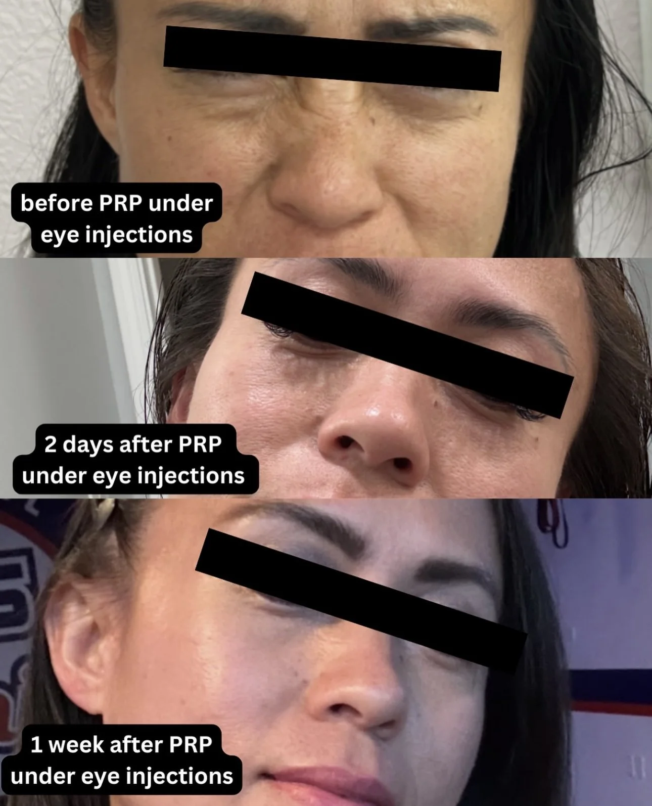 before and afters for website  (2).PNG