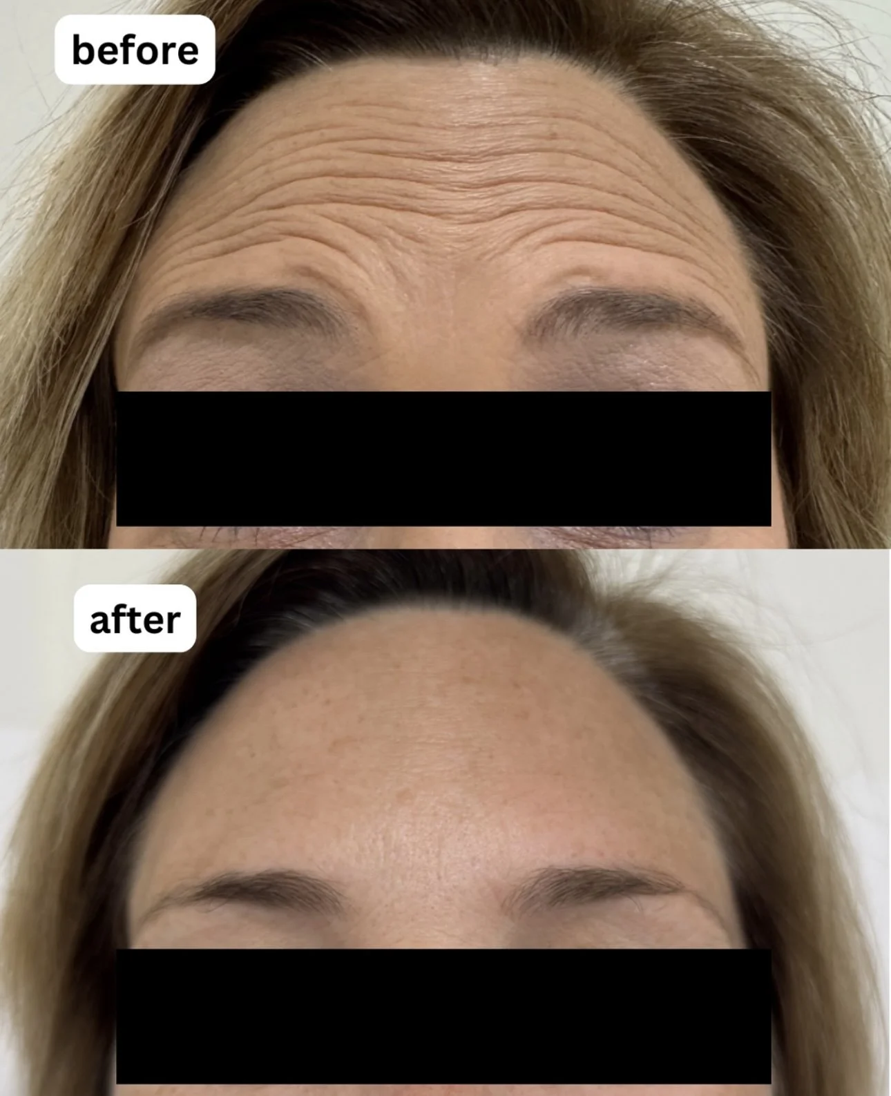 before and afters for website  (1).PNG