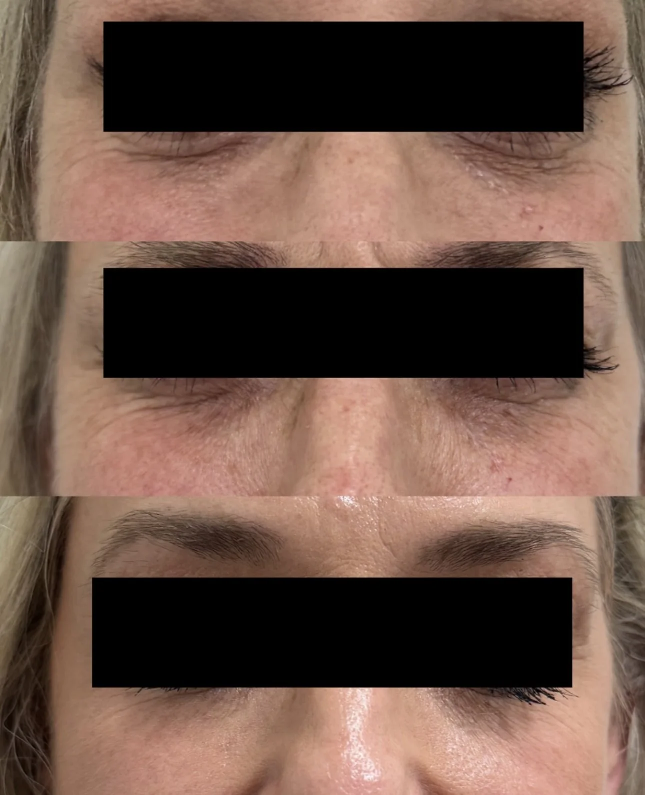 before and afters for website .PNG