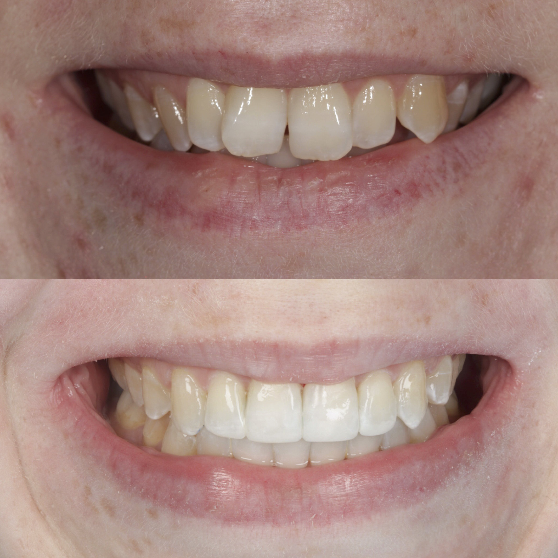 Invisalign Galway Dental Group