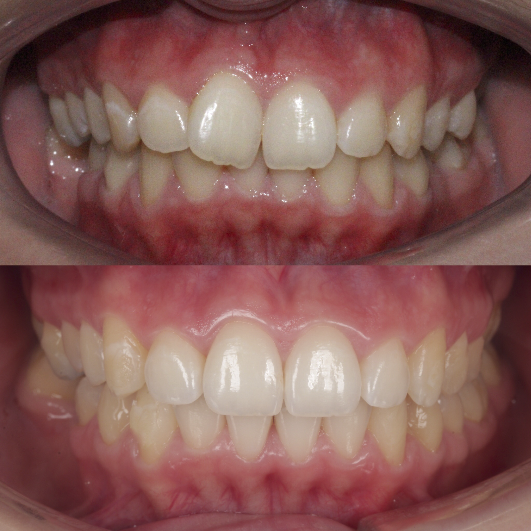 Invisalign Galway Dental Group