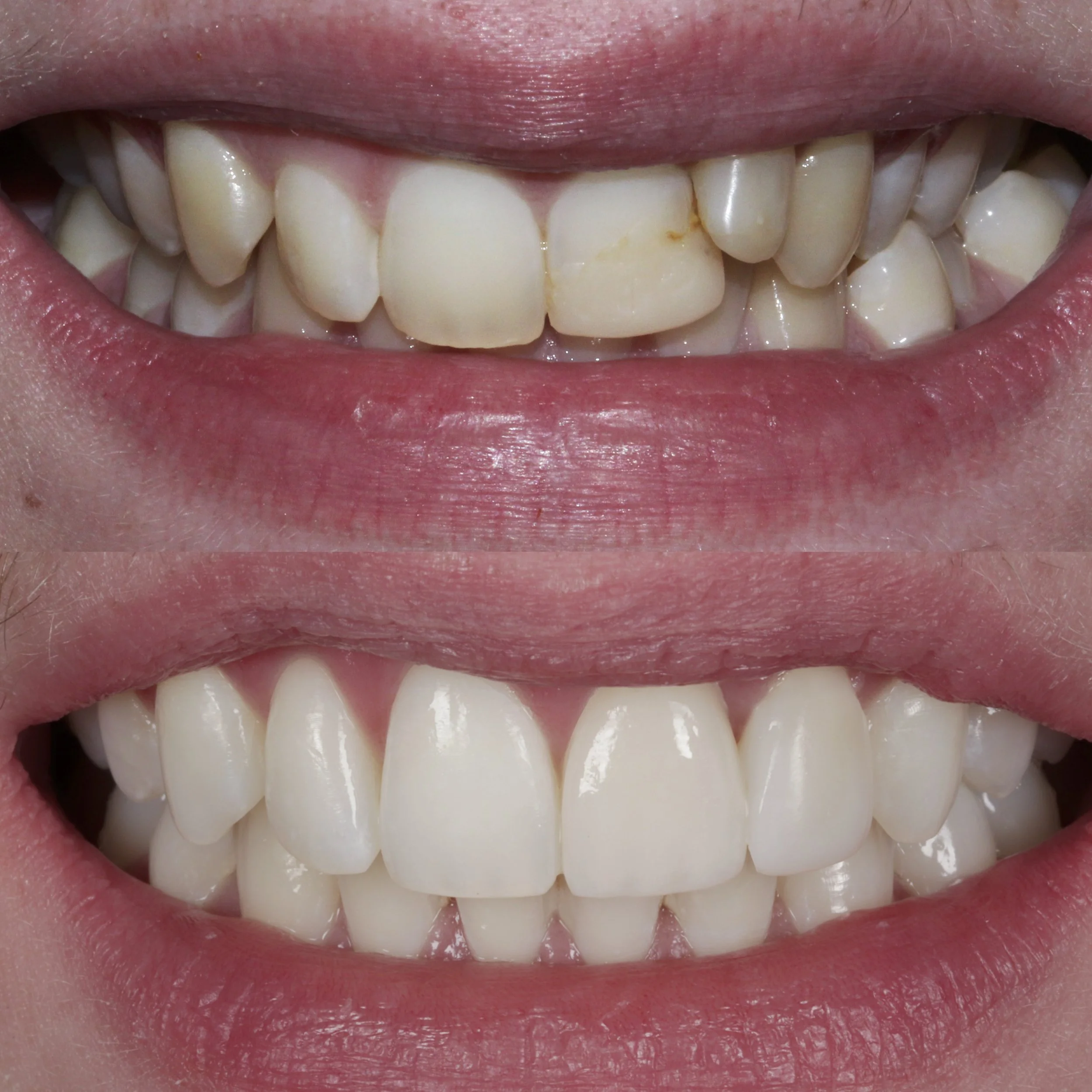 Invisalign Galway Dental Group