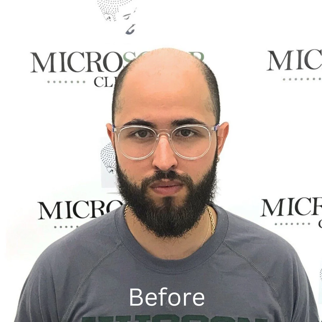A client who needed SMP treatment.