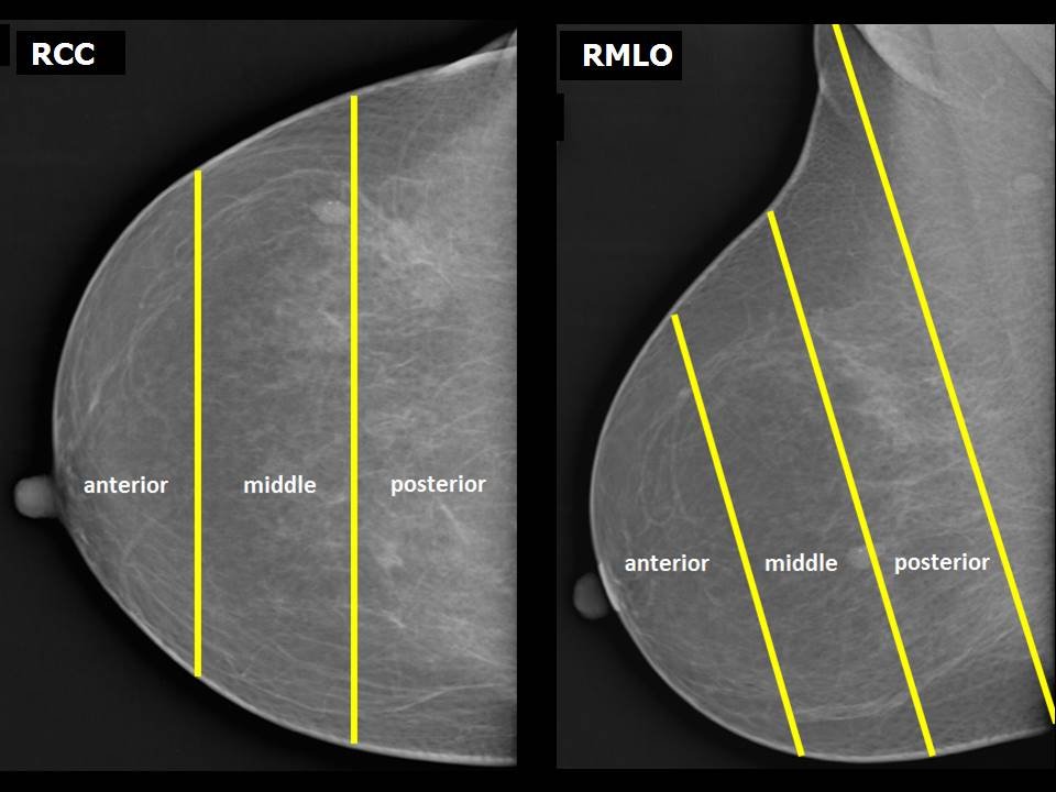 Distance and depth from nipple | Enhance Imaging Precision — Explore ...