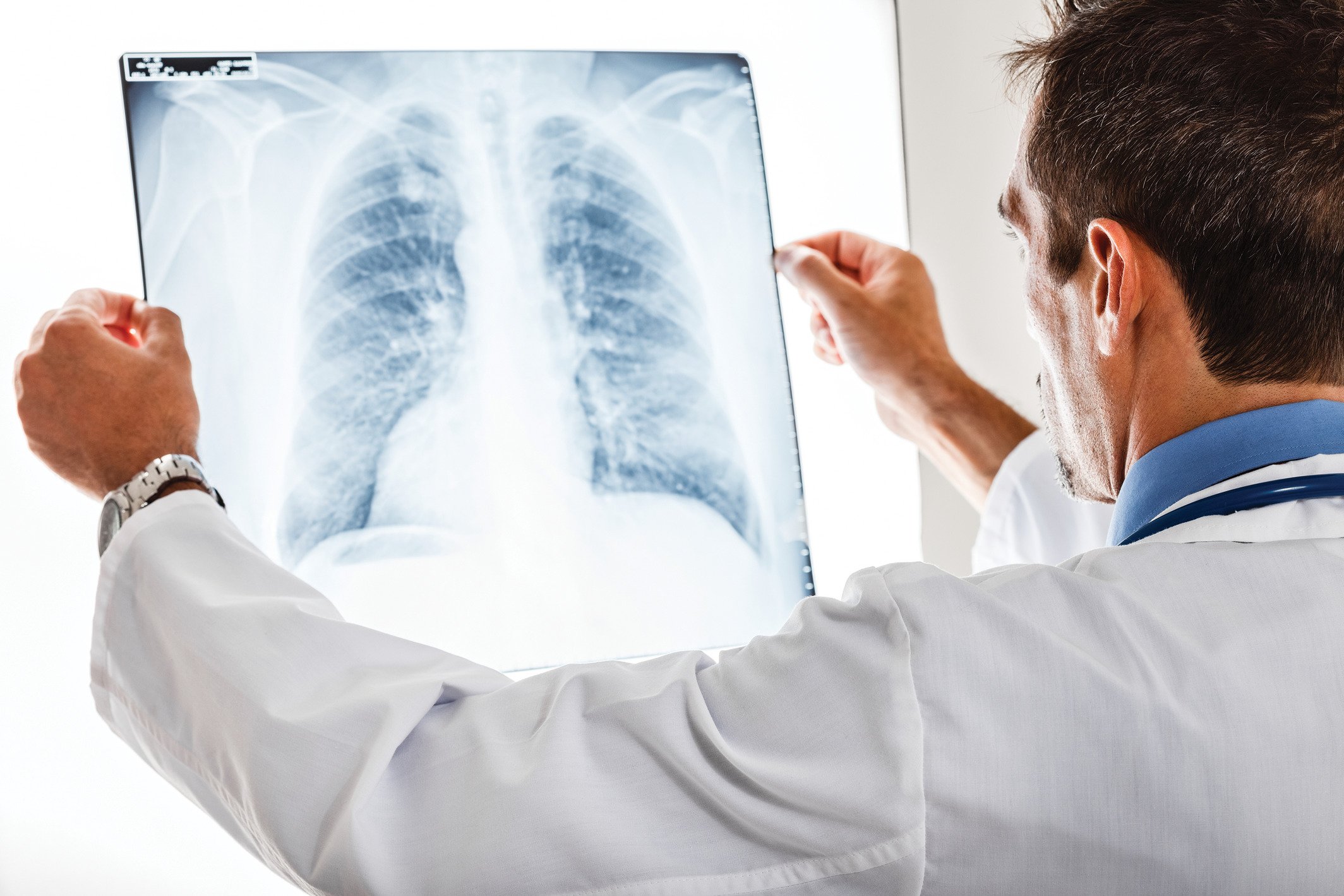   DIGITAL X-RAY   X-ray machines use electromagnetic radiation, passing these particles through the body to capture specialized images of harder bodily structures like bones.   Learn more  