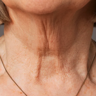 Vitality neck cream: Designed to target signs of aging and hyperpigmentation on the delicate skin of the neck and chest.