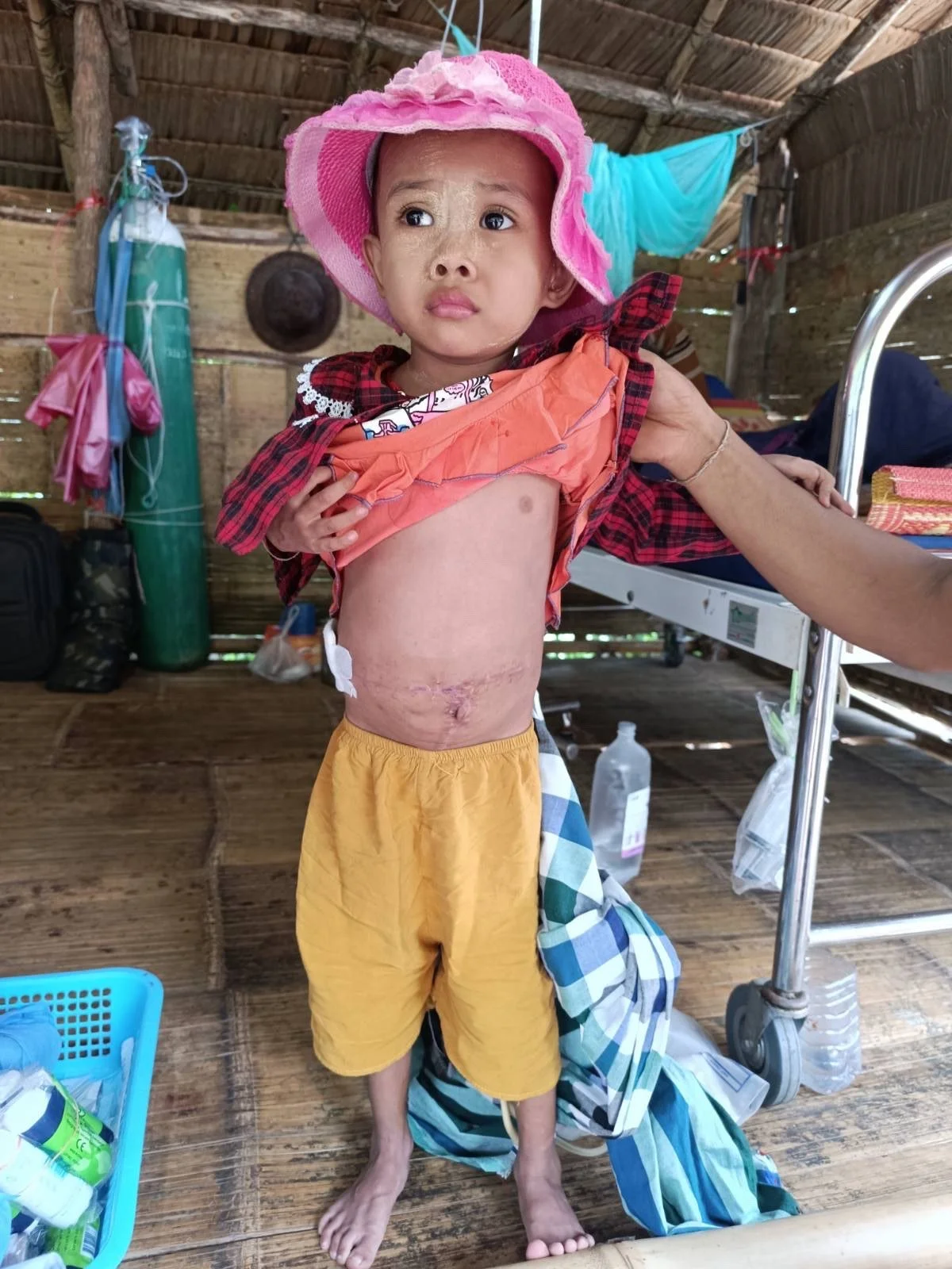 After Operation 2.jpeg