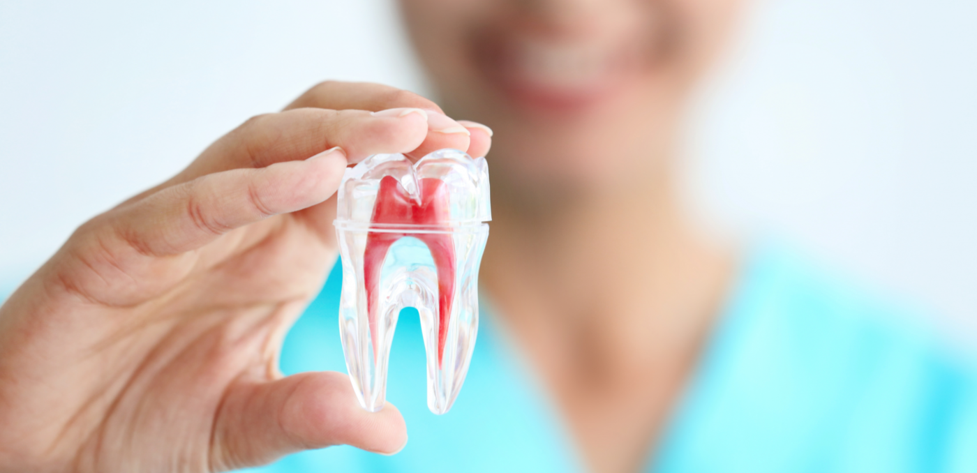 Root-Canal-1400x678.png