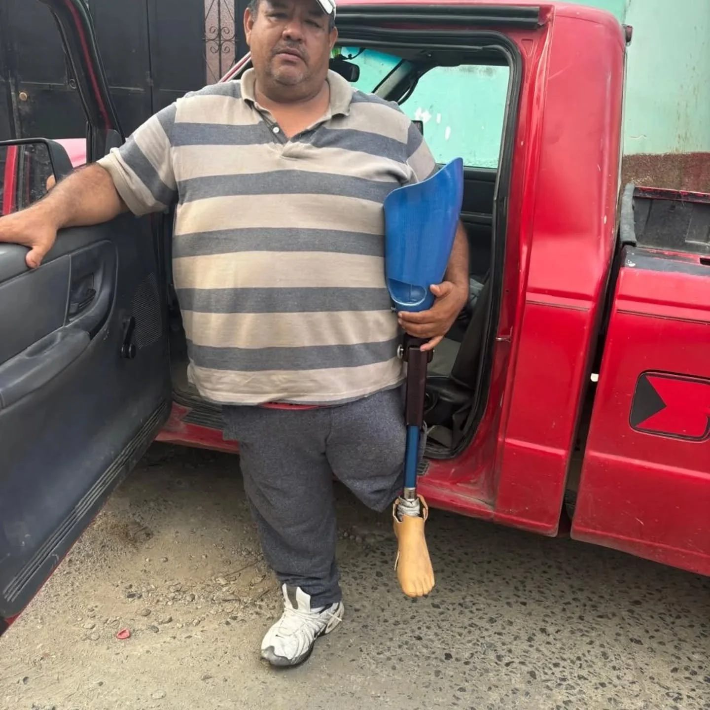 Thanks to the donors at Integrity International, this Guatemalan gentleman received a new left leg. Praise the Lord!