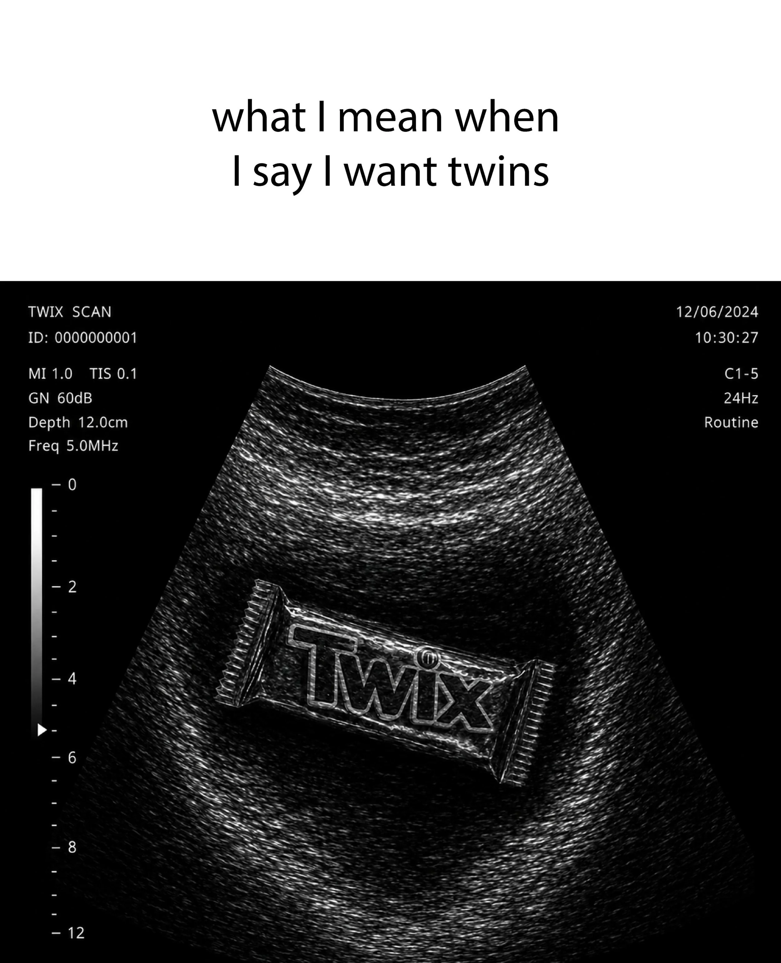 Twix UK