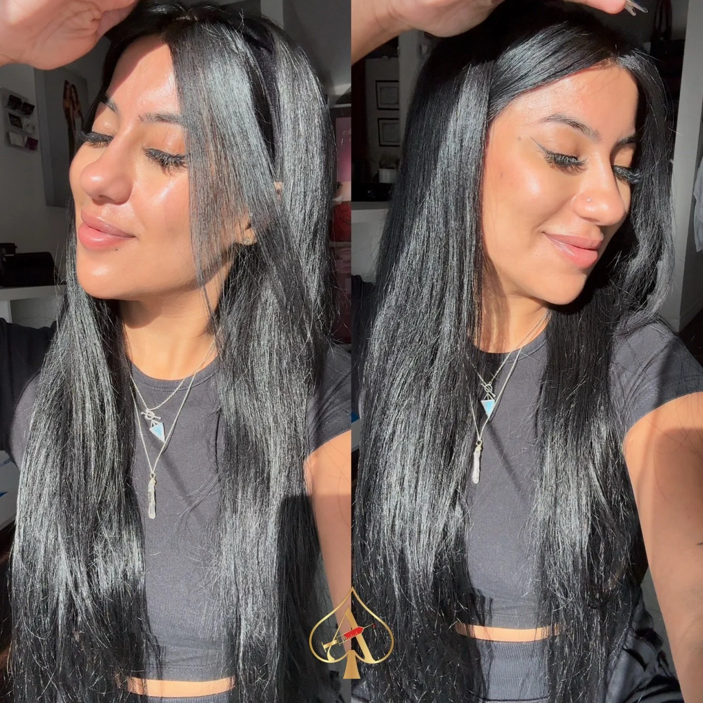 The secret to that &ldquo;no-makeup, just sunscreen&rdquo; glow ✨

One week post Salmon DNA Facial and my skin has been in its plumpest era &mdash; glassy, hydrated, and actually holding moisture in this cold, dry weather.

This treatment is the ulti