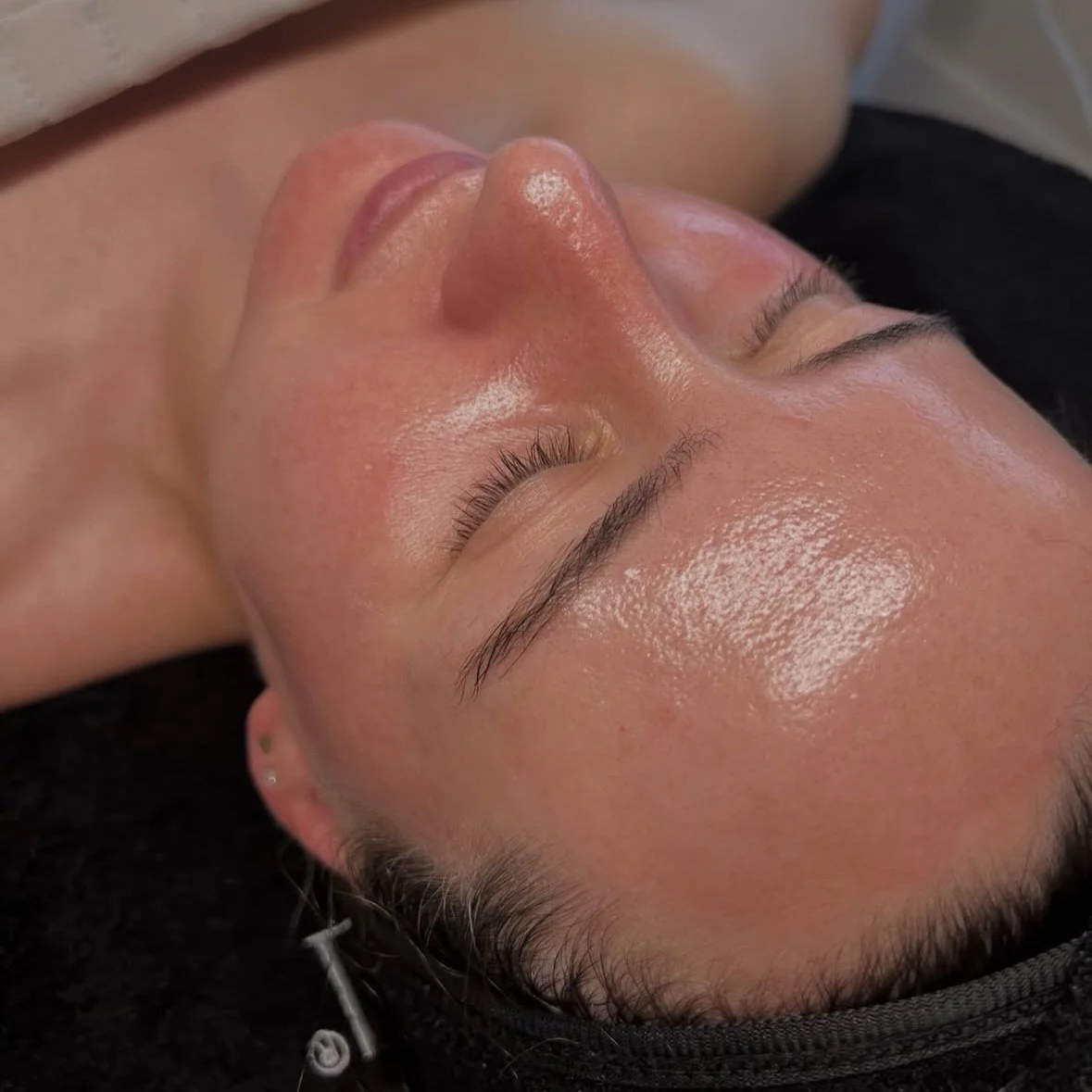 ✨ Salmon DNA Facial &mdash; the glow you can&rsquo;t hide. ✨

If your skin has been looking tired, dull, or &ldquo;stressed,&rdquo; this treatment is your new secret weapon. Salmon DNA (PN/PNN) is packed with regenerative molecules that tell your ski