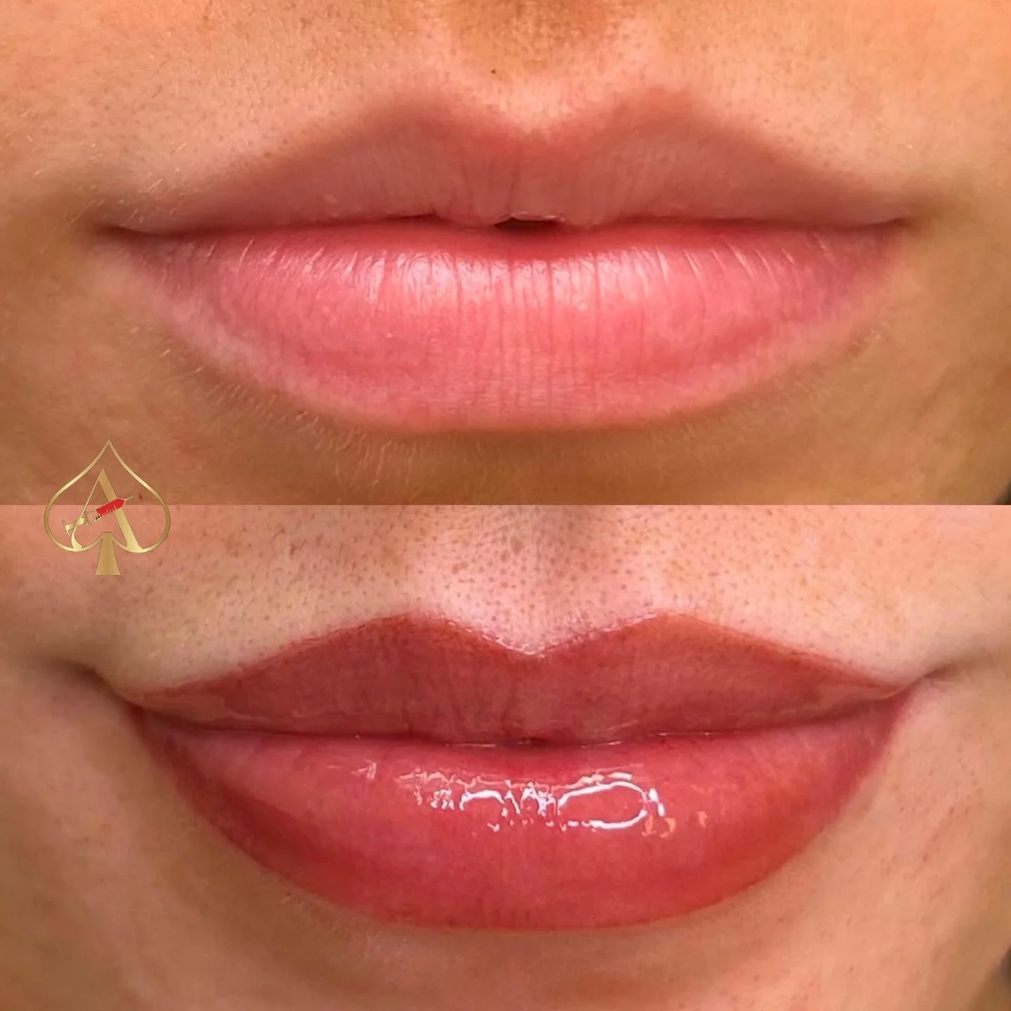 Lip Blush is the ultimate glow-up for your pout:

✔️ Restores natural color + definition
✔️ Creates the illusion of fullness without filler
✔️ Smudge-proof + sweat-proof
✔️ Soft, healed finish that looks like your lips, but better

No more constant r