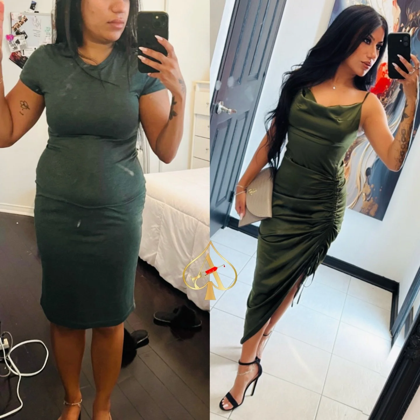 Do permanent fat dissolving injections really work? 

😏&hellip; 🎤⬇️

PCDC permanently destroys stubborn fat cells &mdash; meaning once they&rsquo;re gone, they&rsquo;re gone.

✨ Snatches small pockets of fat
✨ Contours + defines
✨ Boosts workout re