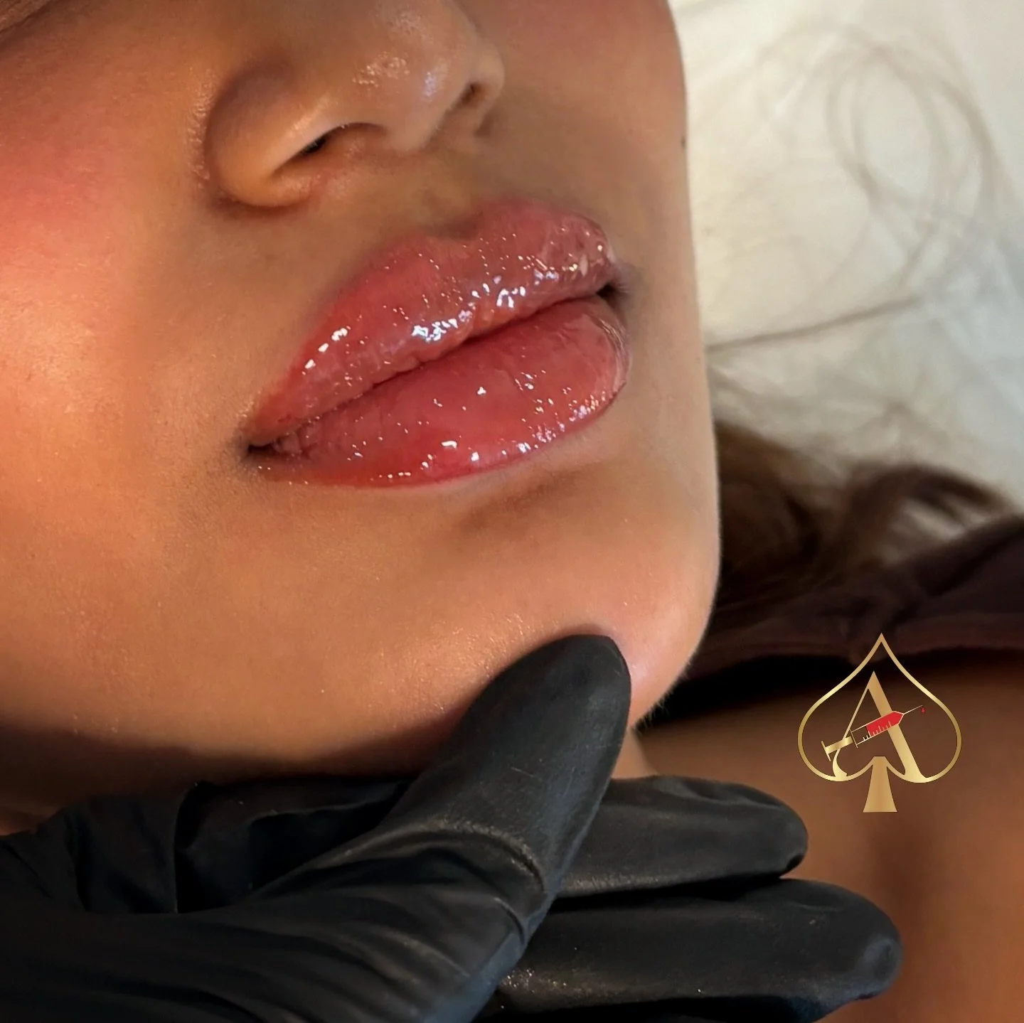 Mini plump, major difference 💋✨

A subtle, natural enhancement for the girls who want just a little more &mdash; not too much.

This Mini Plump is perfect if you&rsquo;re:
&bull; new to lip filler
&bull; a little apprehensive
&bull; wanting soft vol