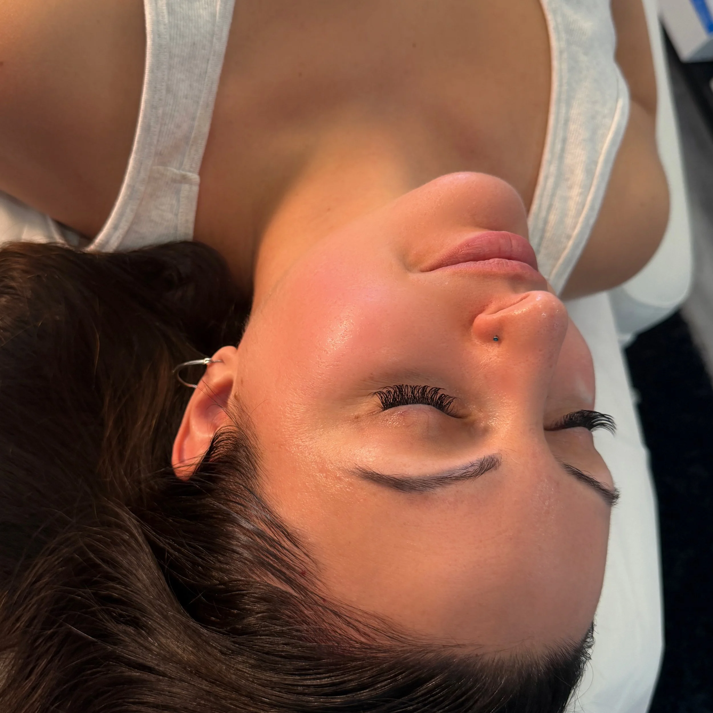 Korean Glass Skin Facial in Brampton | Exosome Skin Rejuvenation