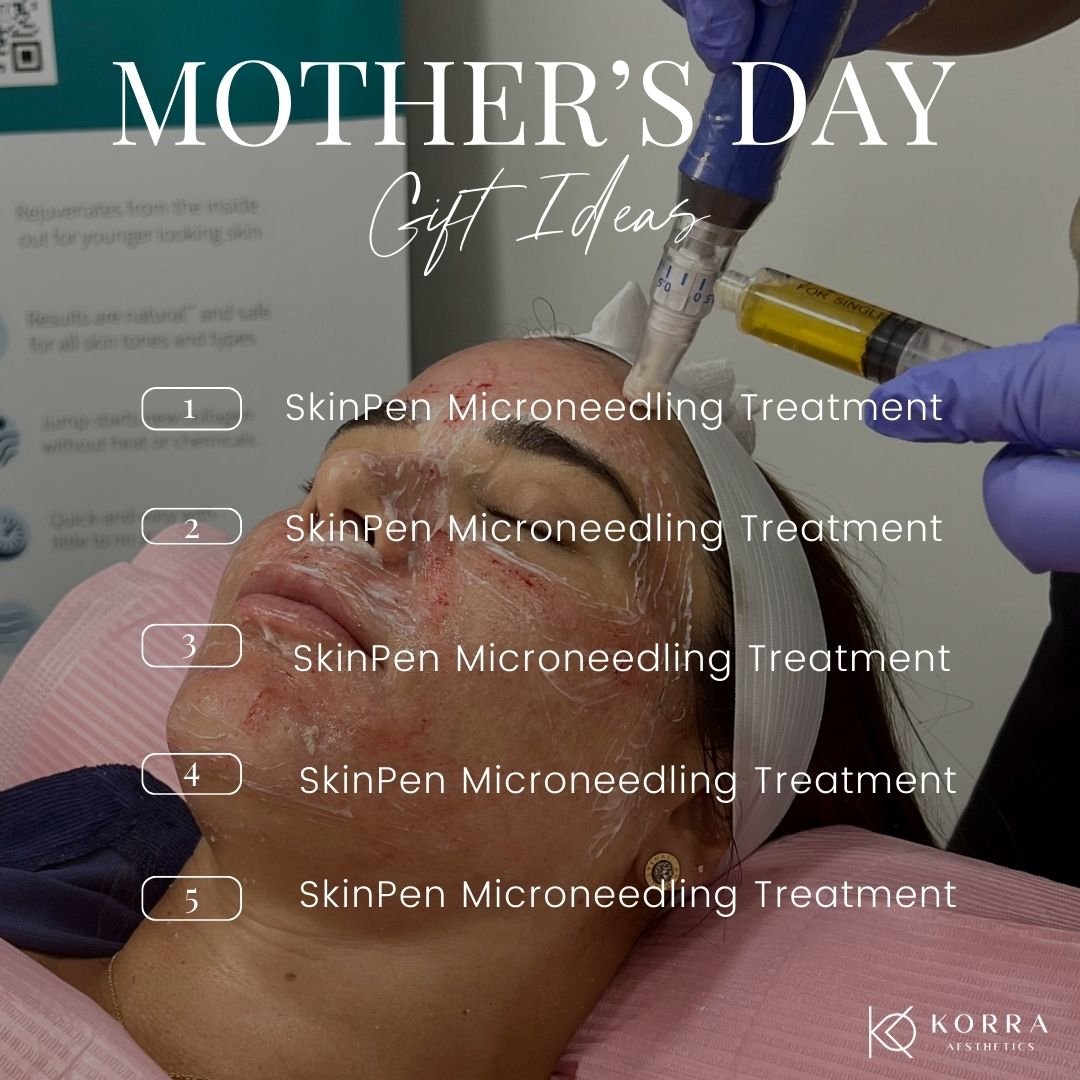 Give the gift of glowing skin this Mother's Day with our SkinPen Microneedling with PRP Treatment package! 🌸 For a limited time, enjoy 3 treatments for $1500 - the perfect pampering gift for the special mom in your life. 💖

Microneedling with PRP h