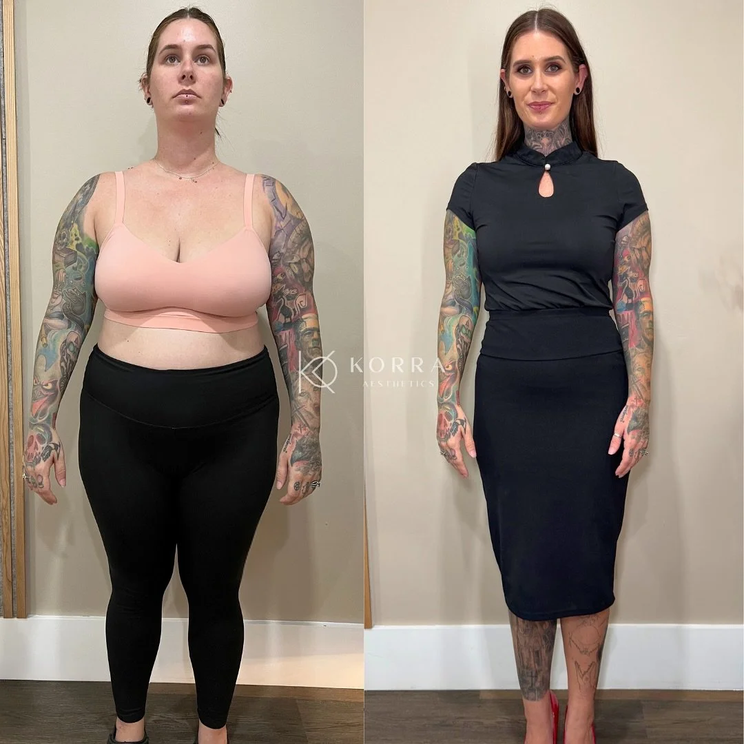 Client Spotlight ✨
When our 31 year old client first started her weight loss journey with us in June 2024, she had just had her baby and was ready to feel like herself again. She started at 206 lbs and finished her first round in December. This Augus