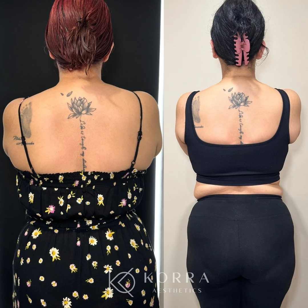 Real results take real life into account. 

Our 28-year-old client &mdash; a busy mom with a full schedule &mdash; started her Semaglutide journey with us toward the end of last year. Her transformation has been steady, sustainable, and at her own pa
