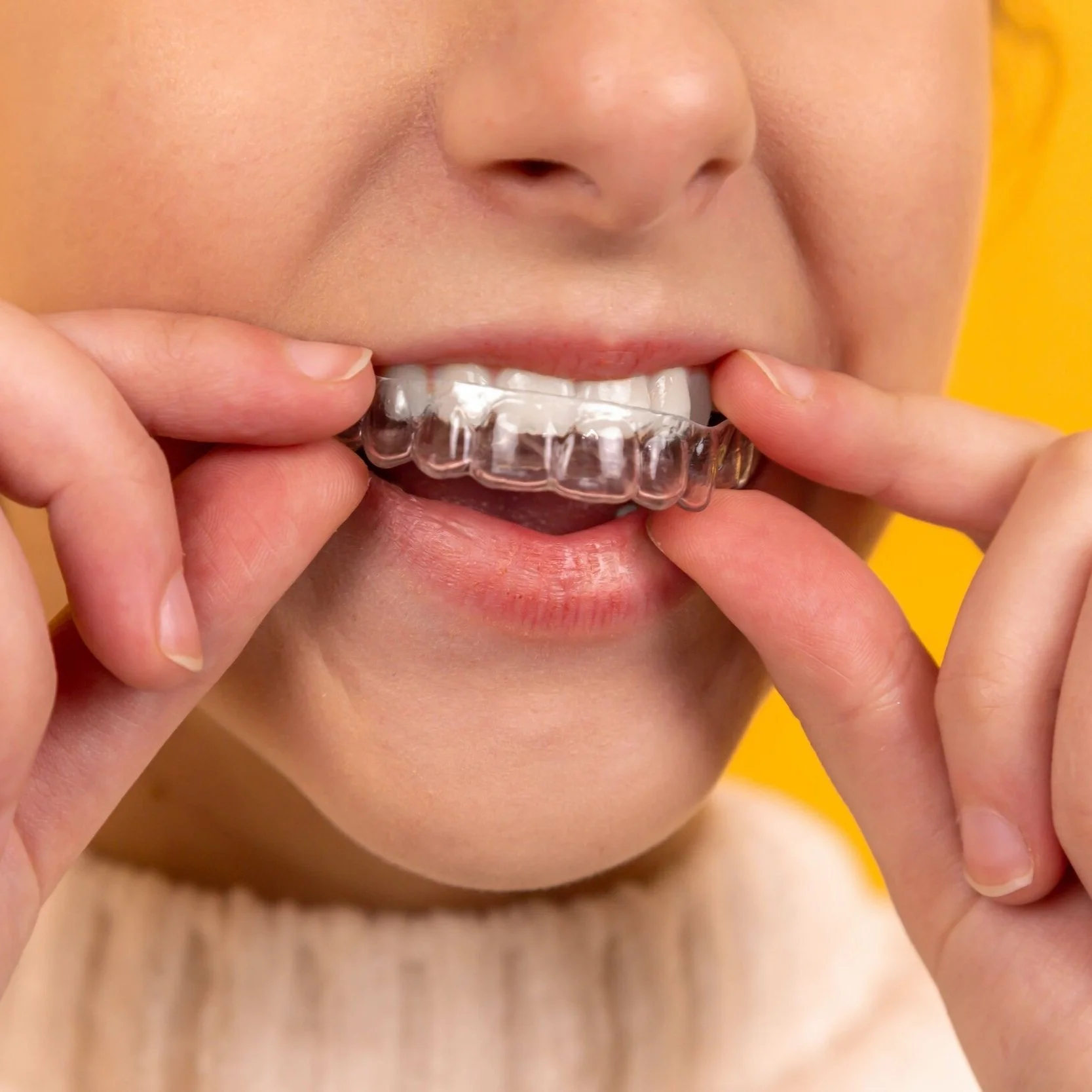 Essix Retainer service