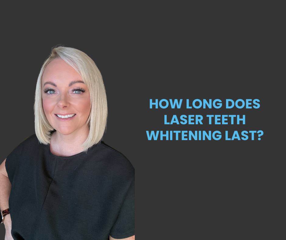 How Long Does Laser Teeth Whitening Last?