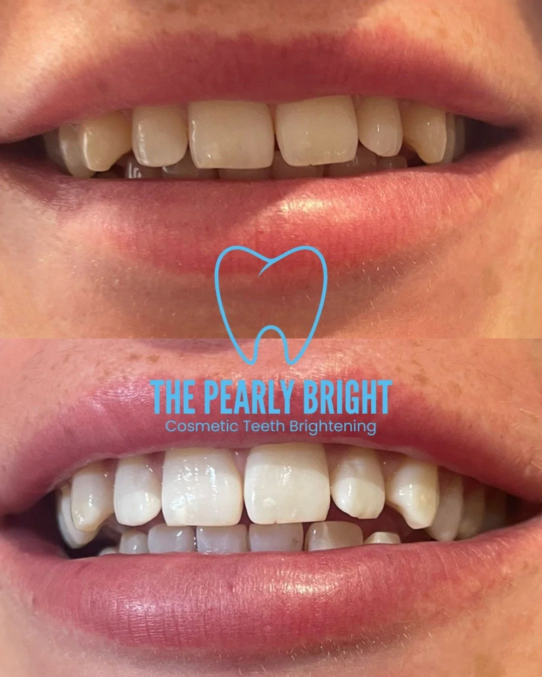 Trying cosmetic teeth brightening for the first time can feel a bit unsure, and that&rsquo;s totally normal.

That&rsquo;s why everything here is set up to help you feel relaxed from the moment you walk in. It&rsquo;s a calm, private, home-based spac