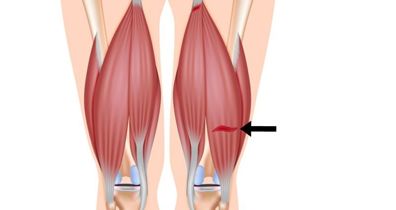Old: Hamstring Strains