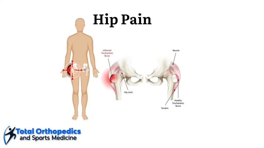 Undiagnosed Hip Injury: Lindsey’s Story
